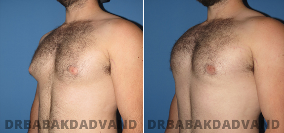 Before and After Treatment Photos