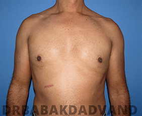Before and After Treatment Photos: Adults